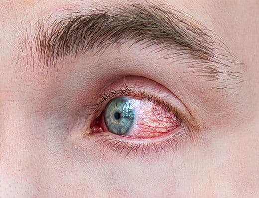 Diabetic Retinopathy Treatment 