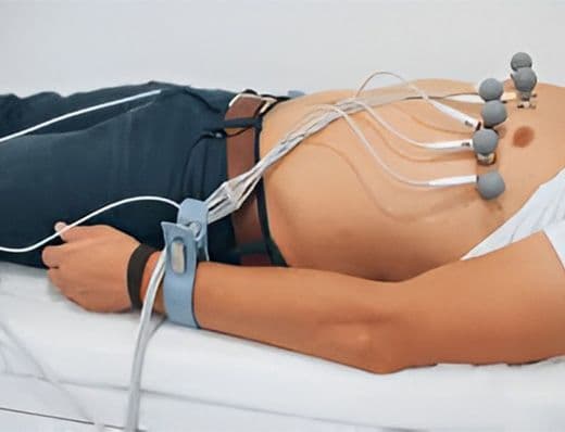 ECG (Electrocardiogram)
