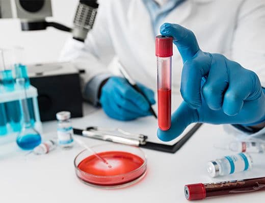 Blood Tests & Laboratory Investigations